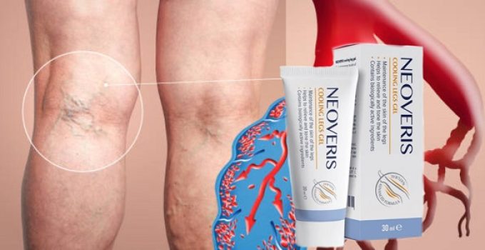 Neoveris gél na kŕčové žily. Cena, recenzie a efekty?<span class='lazyload yasr-stars-title-average'><div class='yasr-stars-title yasr-rater-stars'
 id='yasr-overall-rating-rater-cc9700946516c'
 data-rating='4.6'
 data-rater-starsize='16'></div></span>