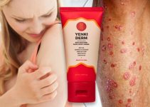 Yenki Derm Recenzie – pre rýchle zotavenie z psoriázy