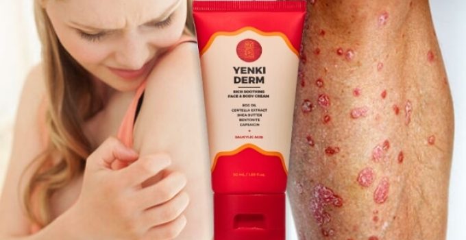 Yenki Derm Recenzie – pre rýchle zotavenie z psoriázy<span class='yasr-stars-title-average'><div class='yasr-stars-title yasr-rater-stars'
 id='yasr-overall-rating-rater-8616276f8e338'
 data-rating='4.8'
 data-rater-starsize='16'>
 </div></span>