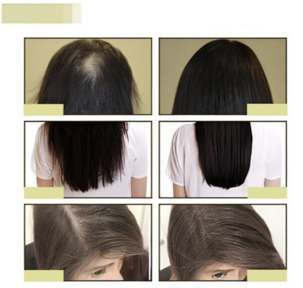 EELHOE Hair Growth Oil – čo to je a ako to funguje